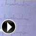 Dottor Totò Giujusa - Screening cardiologico