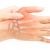 Artrosi della mano: Rizoartrosi