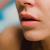Herpes e alimentazione, ci sono correlazioni?