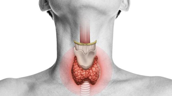 noduli-tiroide-brancatella