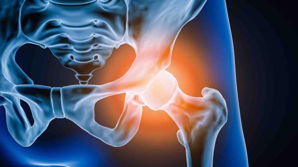 Medicina rigenerativa per l'artrosi d'anca