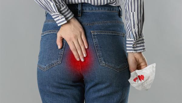 Rettorragia: cos'è, quali sono le cause e quando preoccuparsi