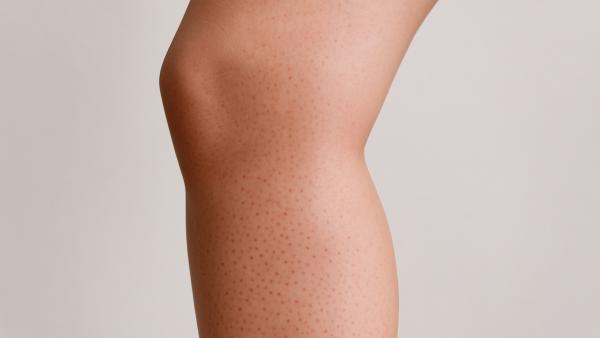 Gambe con puntini rossi