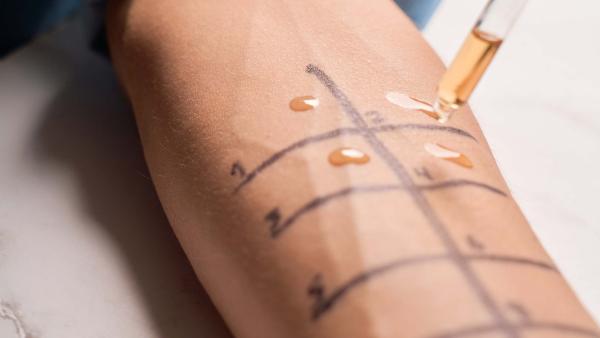 Prick test per allergie