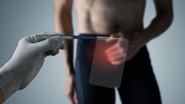 Pancia che sporge cause