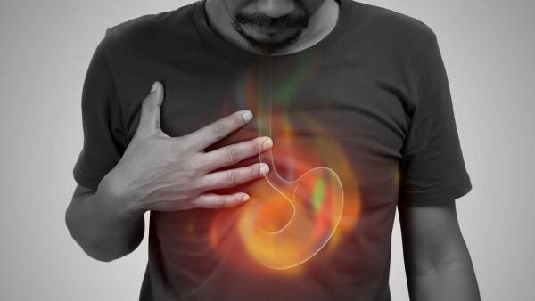 Esofagite da reflusso: cos’è, sintomi, diagnosi e terapie