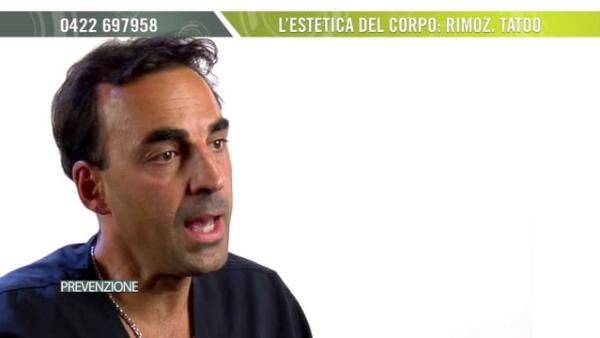 Rimozione dei tatuaggi