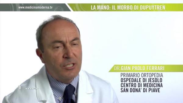 Dottor Gian Paolo Ferrari - Il morbo di Dupuytren della mano