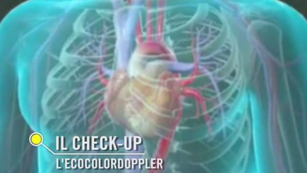IL CHECK UP: L'ECOCOLORDOPPLER