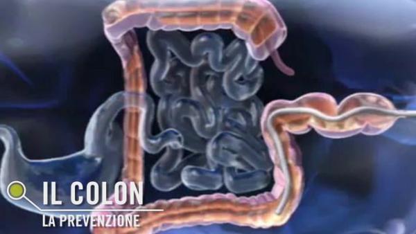 Le patologie del colon, la prevenzione delle malattie dell'ultimo tratto intestinale