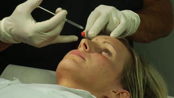 Medicina estetica: la soft restoration