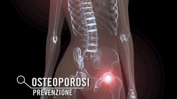 OSTEOPOROSI: LA PREVENZIONE