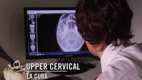 UPPER CERVICAL: LA CURA