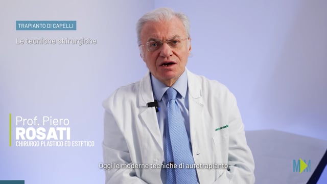 Le principali tecniche per il trapianto di capelli