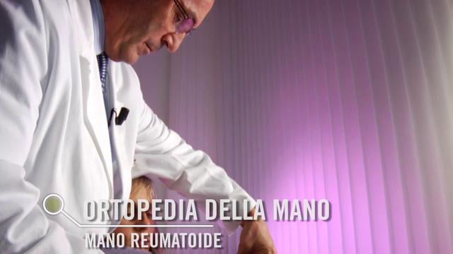Ortopedia della mano: mano reumatoide